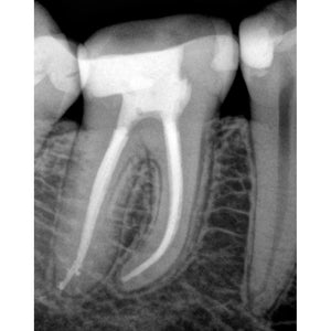 Advanced Conservative Endodontics - From Root to Restoration