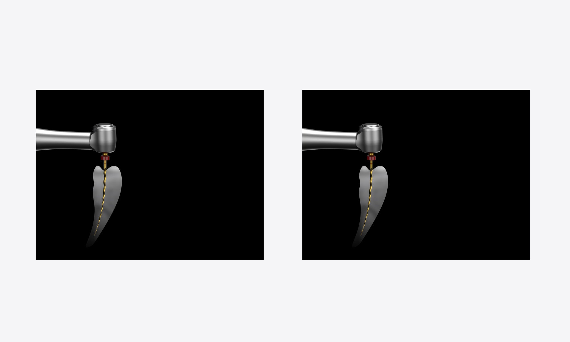 Woodpecker Endo Smart Pro endodontic motor with built-in apex locator
