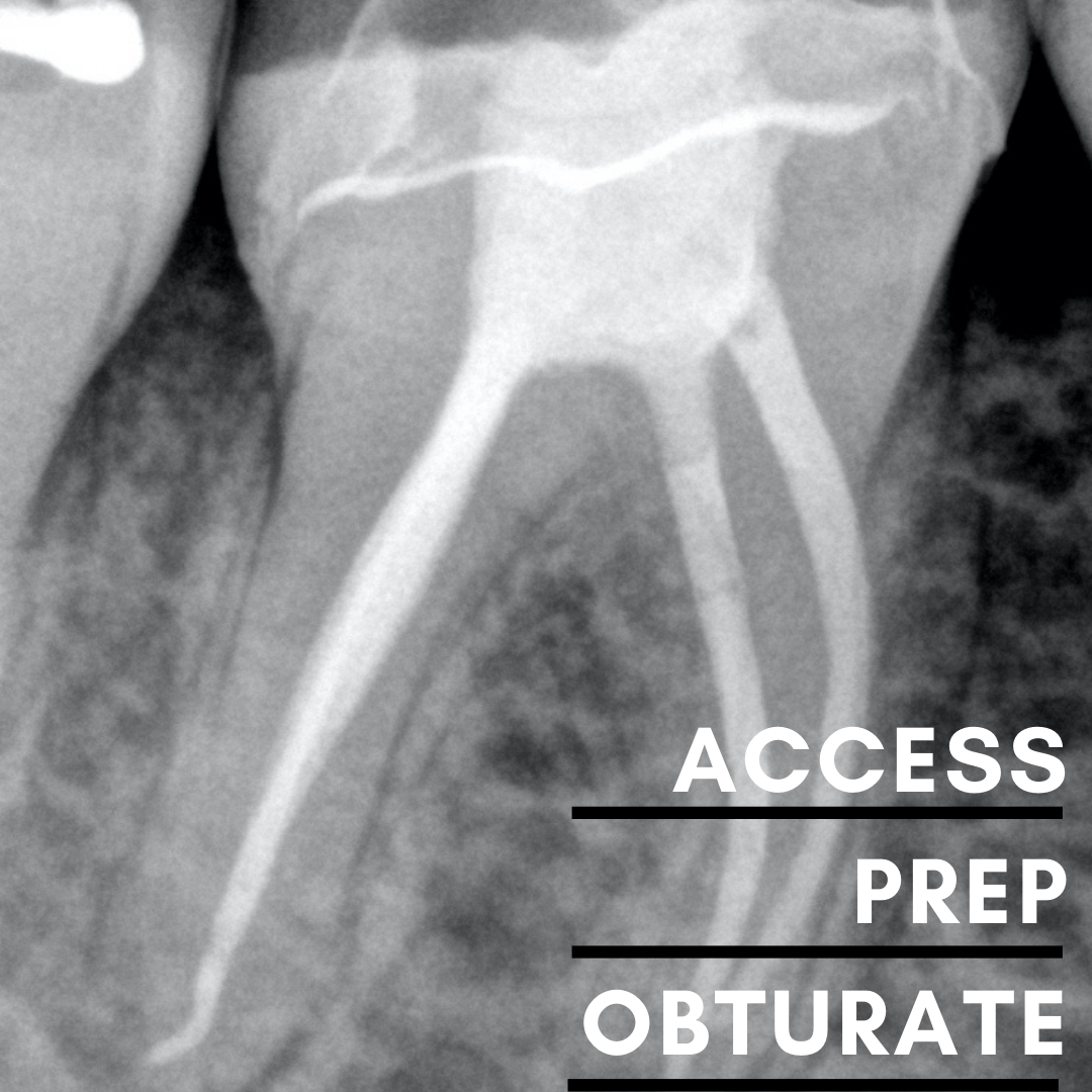 Endodontic Access, Prep & Obturate - Sydney 12 June 2026