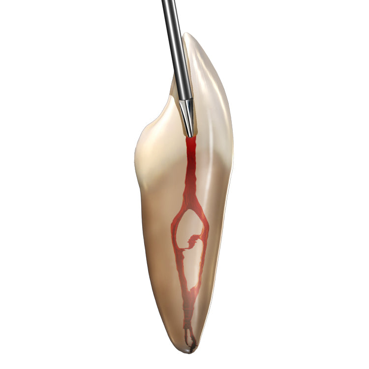 SS White Endoguide EG2 (5pk)