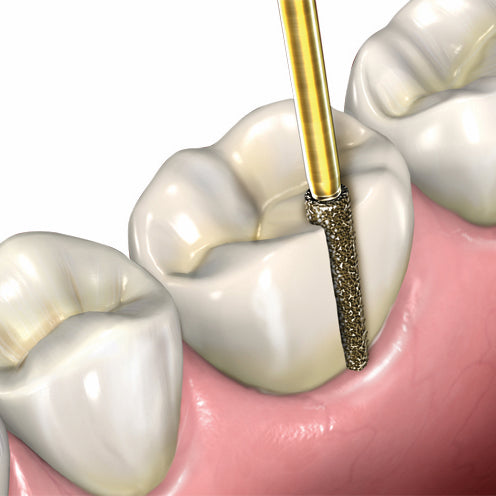SS White Great White Zirconia Cutting Bur - Tapered