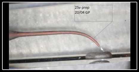 We've Been Doing Some Experiments with Obturating V Taper Preparations