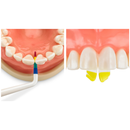 Bioclear Black Triangle/Anterior Composite Hands-on course - Sydney 13 June 2026