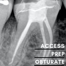 Endodontic Access, Prep & Obturate - Sunshine Coast 6 November 2026