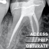 Endodontic Access, Prep & Obturate - Sunshine Coast 6 November 2026