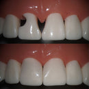 The Bioclear Injection Moulding Technique for Composites - Adelaide 30 May 2026