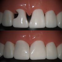 The Bioclear Injection Moulding Technique for Composites - Adelaide 30 May 2026