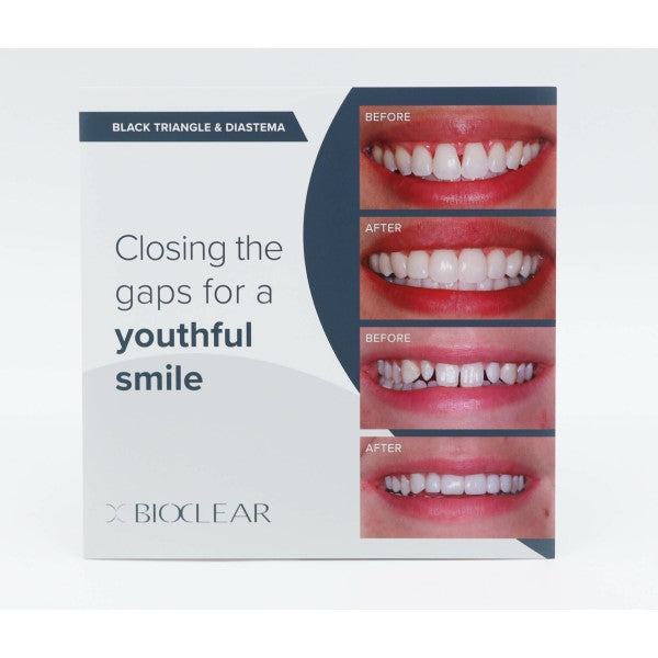 Bioclear Patient Brochures - 10 Pack