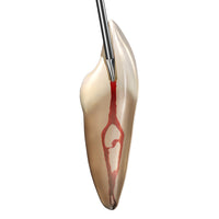 SS White Endoguide EG2 (5pk)